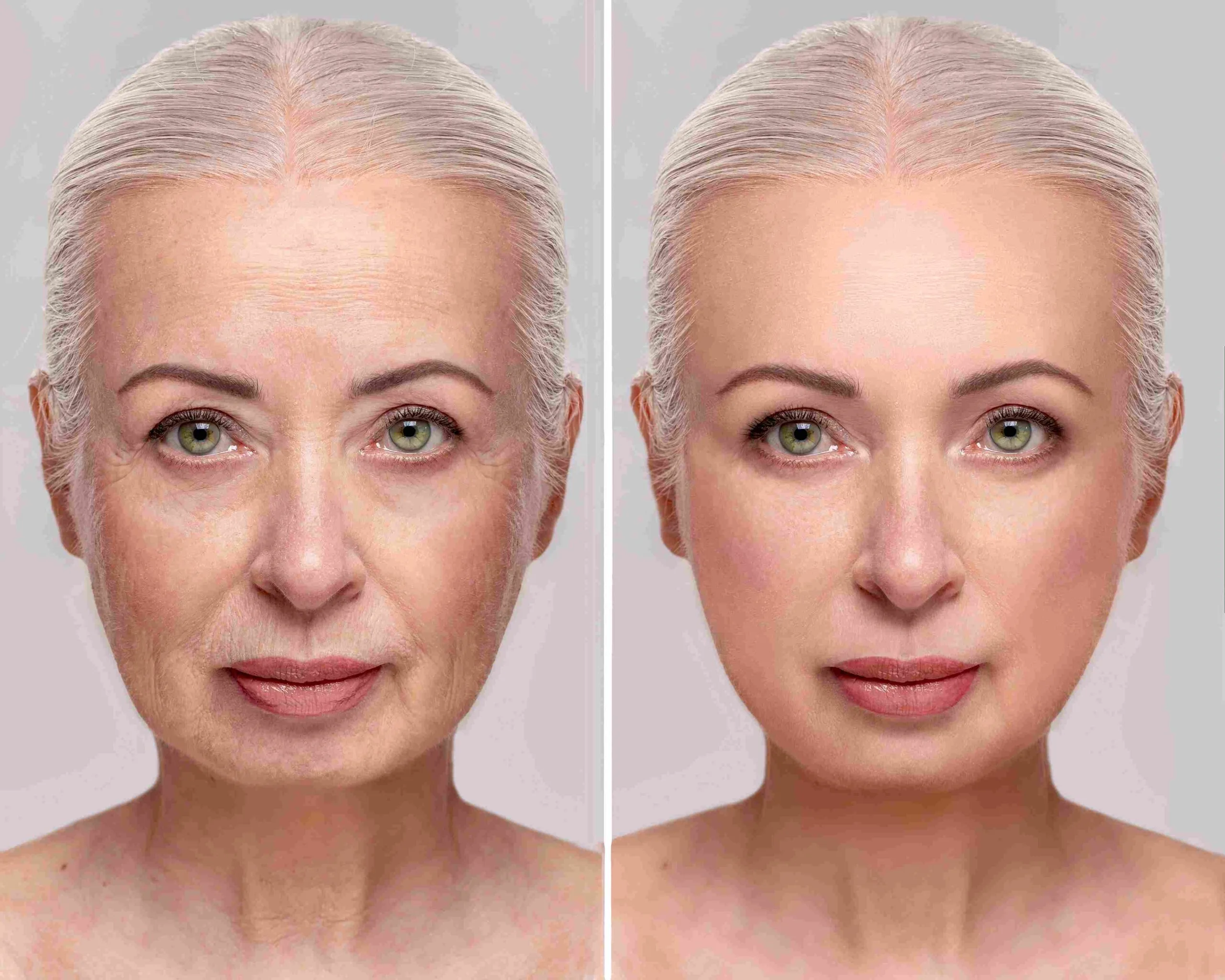 Gezicht transformatie voor en na bewerking